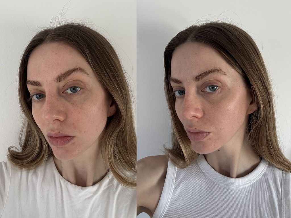 Paula's Choice BHA Liquid Exfoliant before and after | Space NK Paula's Choice BHA Liquid Exfoliant before and after | Space NK